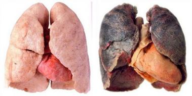 Sigaranın Zarar Verdiği Organlar
